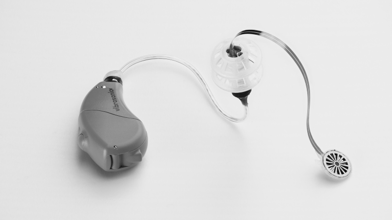 Vibrosonic hearing contact lens device